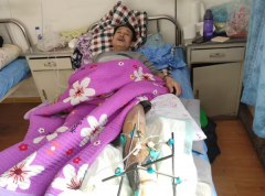 <b>白山市江源区财源煤矿借钱给出事矿工救治却不让其打官司？</b>